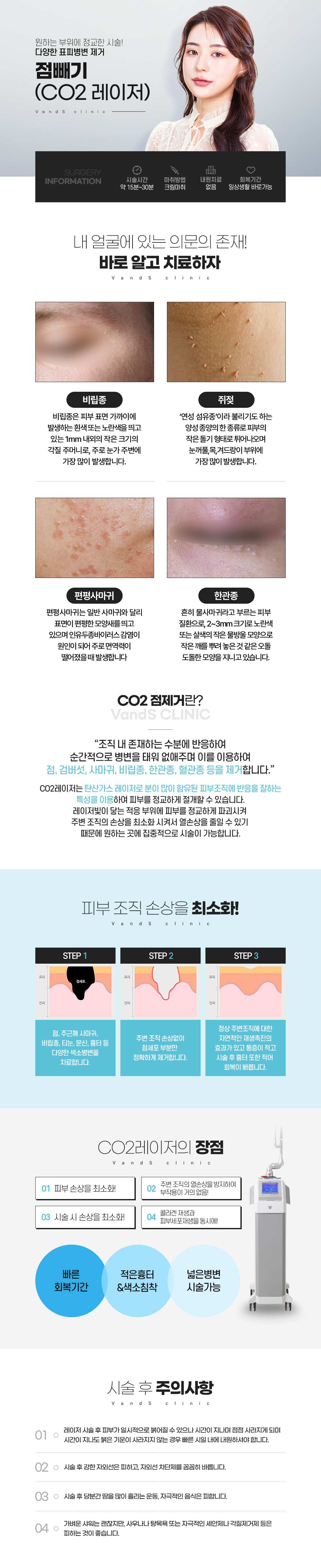 점제거/비립종제거/쥐젖제거/사마귀제거/한관종제거 시술안내 이미지1
