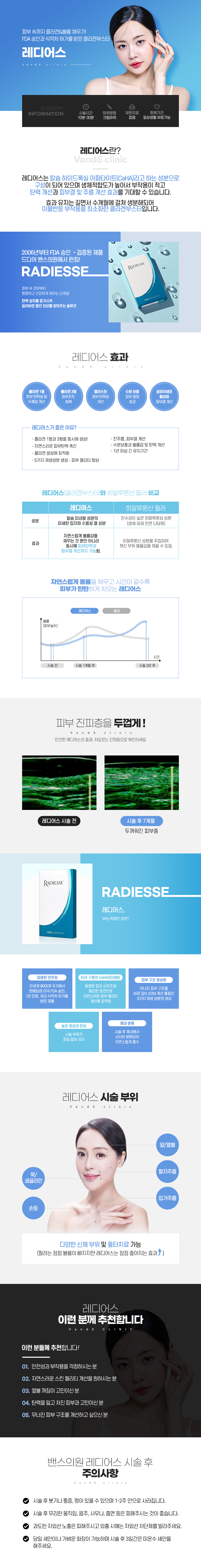 레디어스 시술안내 이미지1