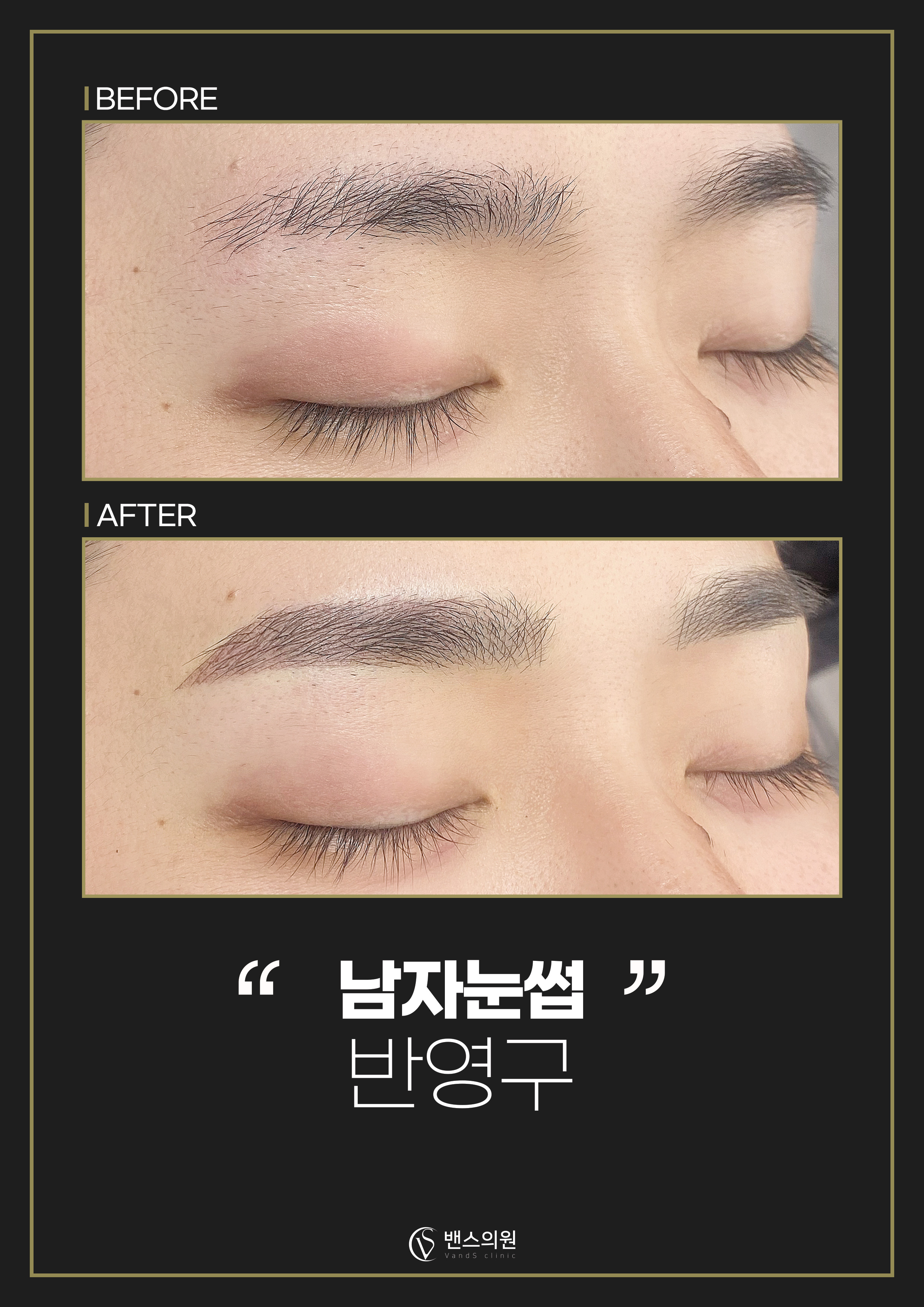 기본색소 눈썹 반영구 시술안내 이미지6