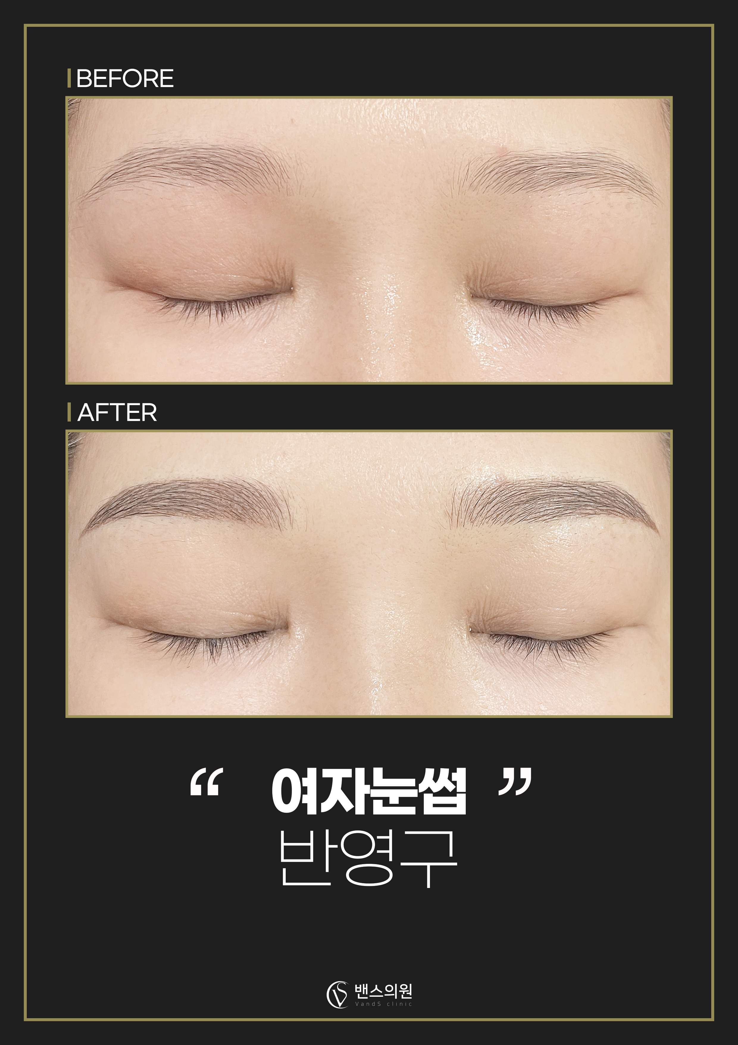 프리미엄메디컬색소 눈썹 반영구  시술안내 이미지8
