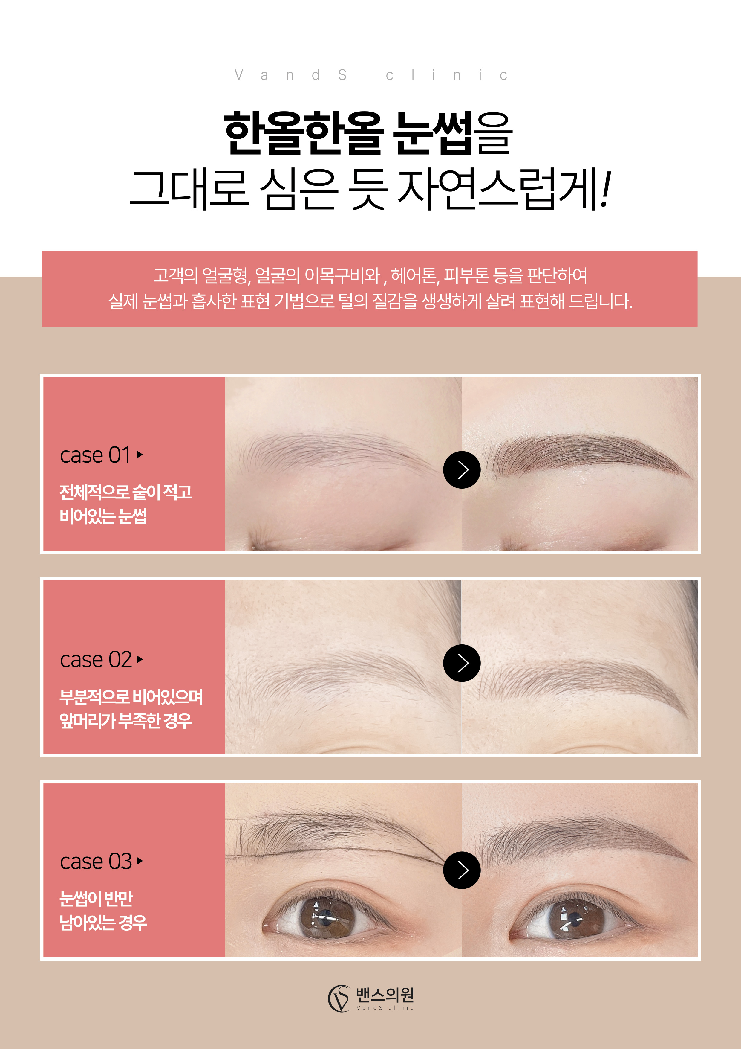 프리미엄메디컬색소 눈썹 반영구  시술안내 이미지5