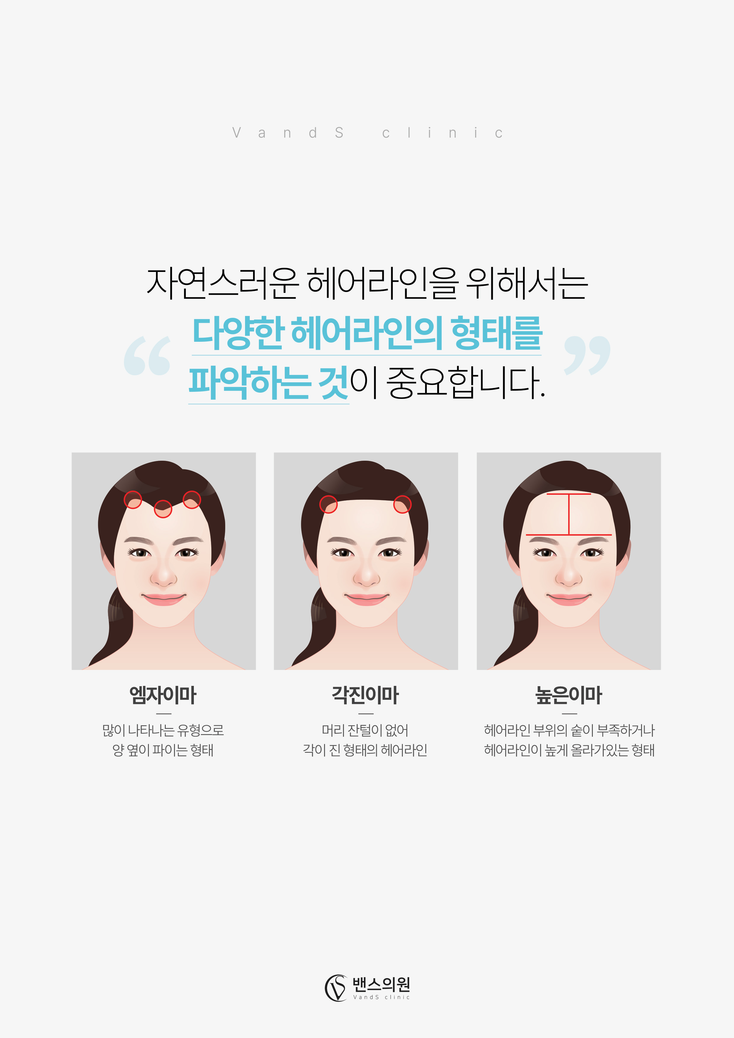 기본색소 헤어라인 반영구 시술안내 이미지3