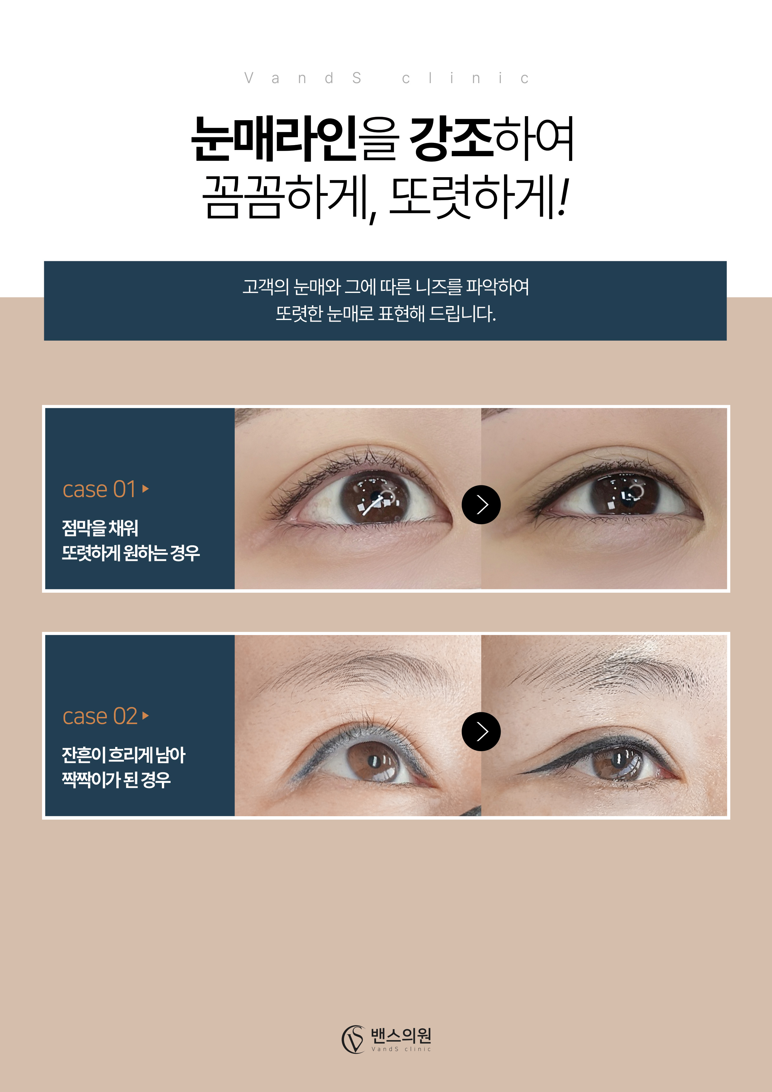 프리미엄메디컬색소 아이라인 반영구 시술안내 이미지2