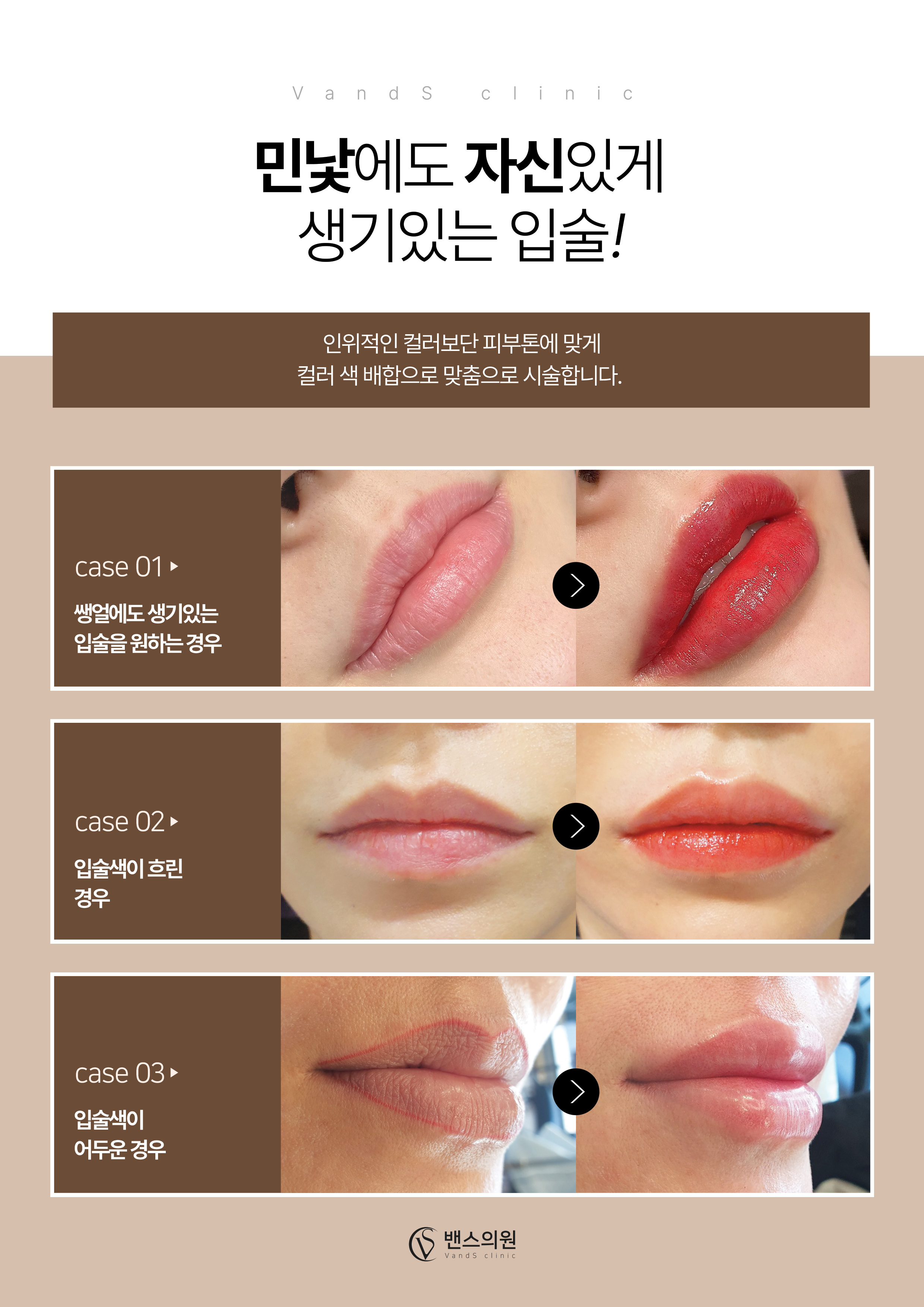 기본색소 입술반영구 시술안내 이미지5