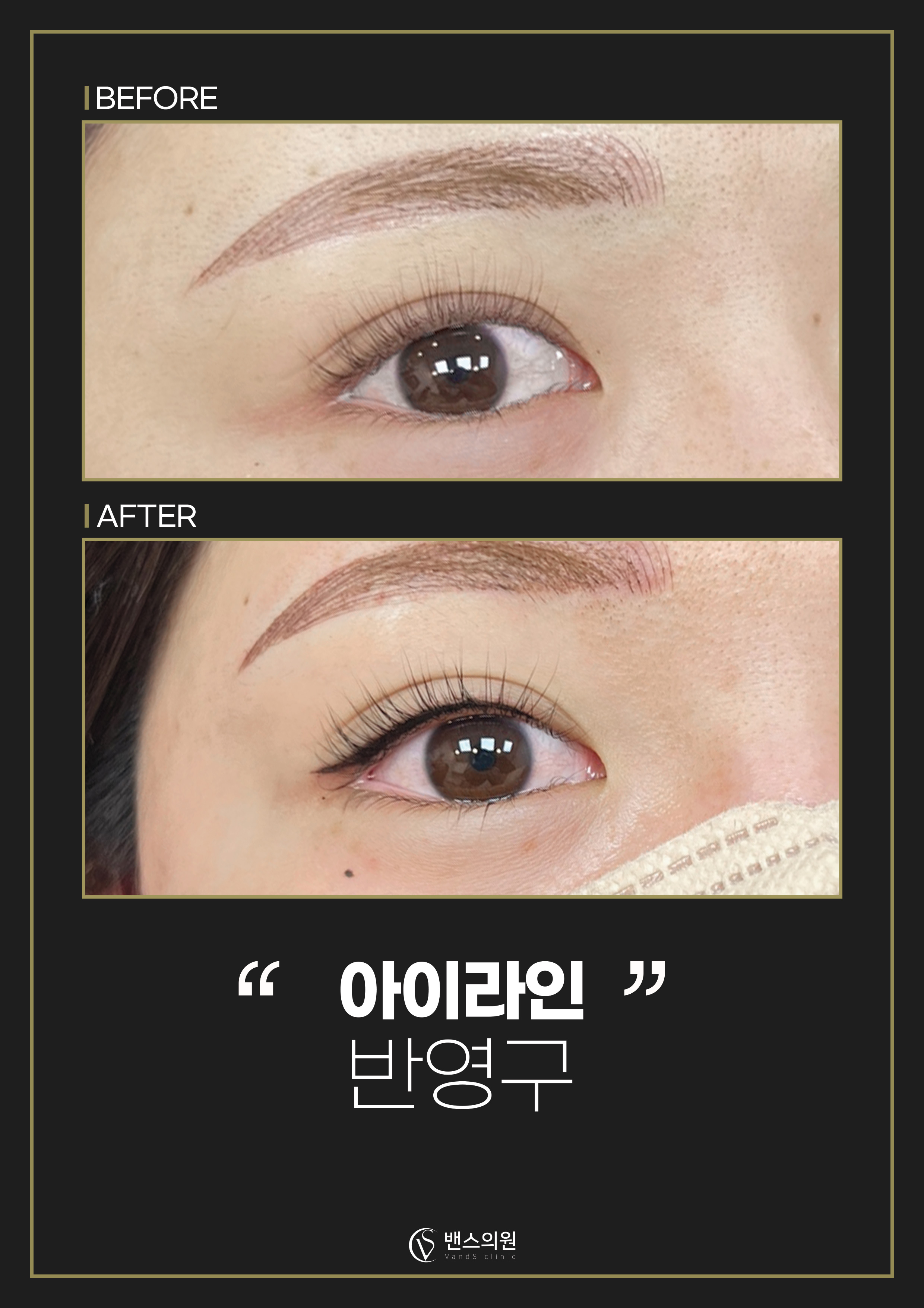 기본색소 아이라인 반영구 시술안내 이미지3