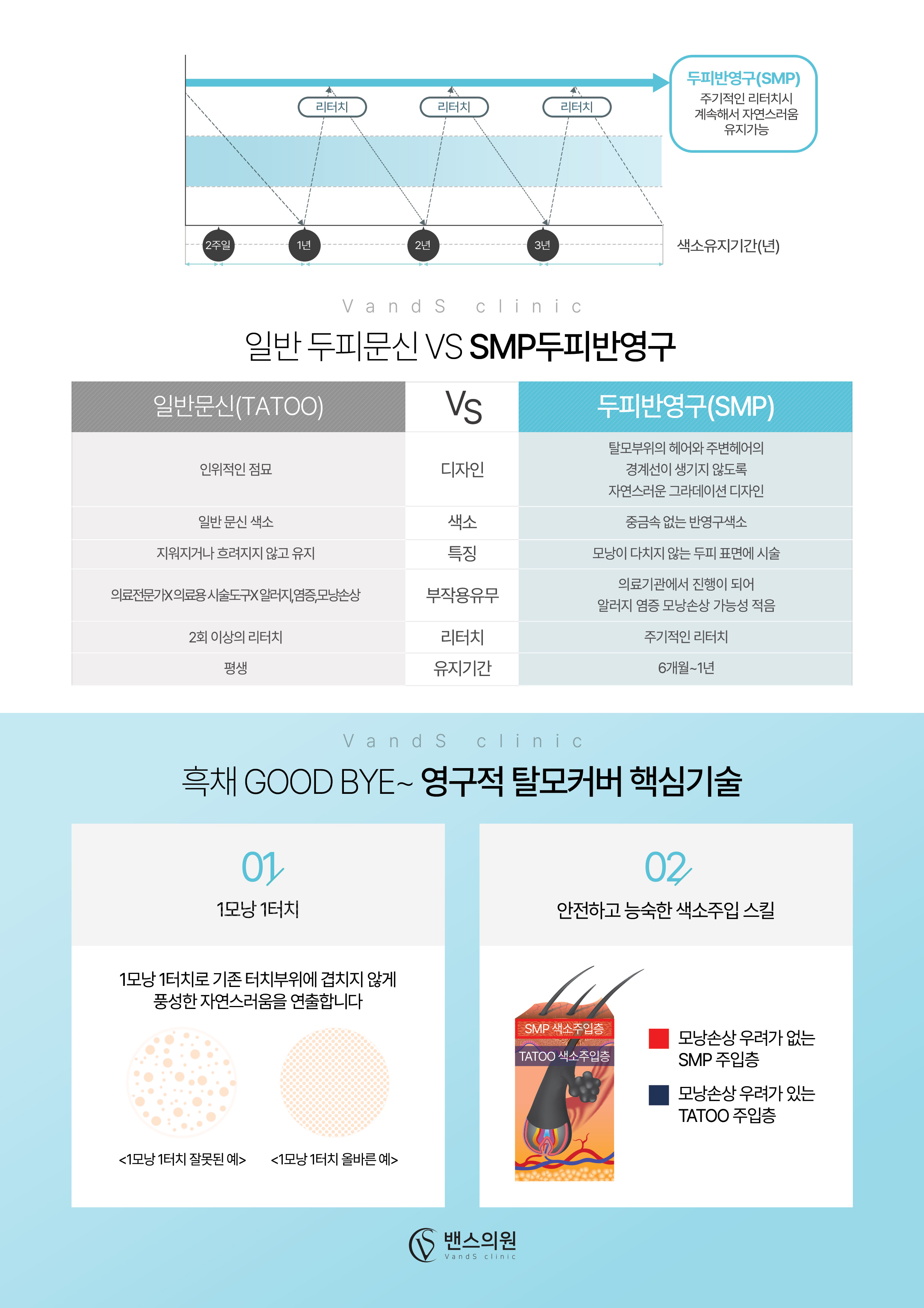 SMP두피 시술안내 이미지2